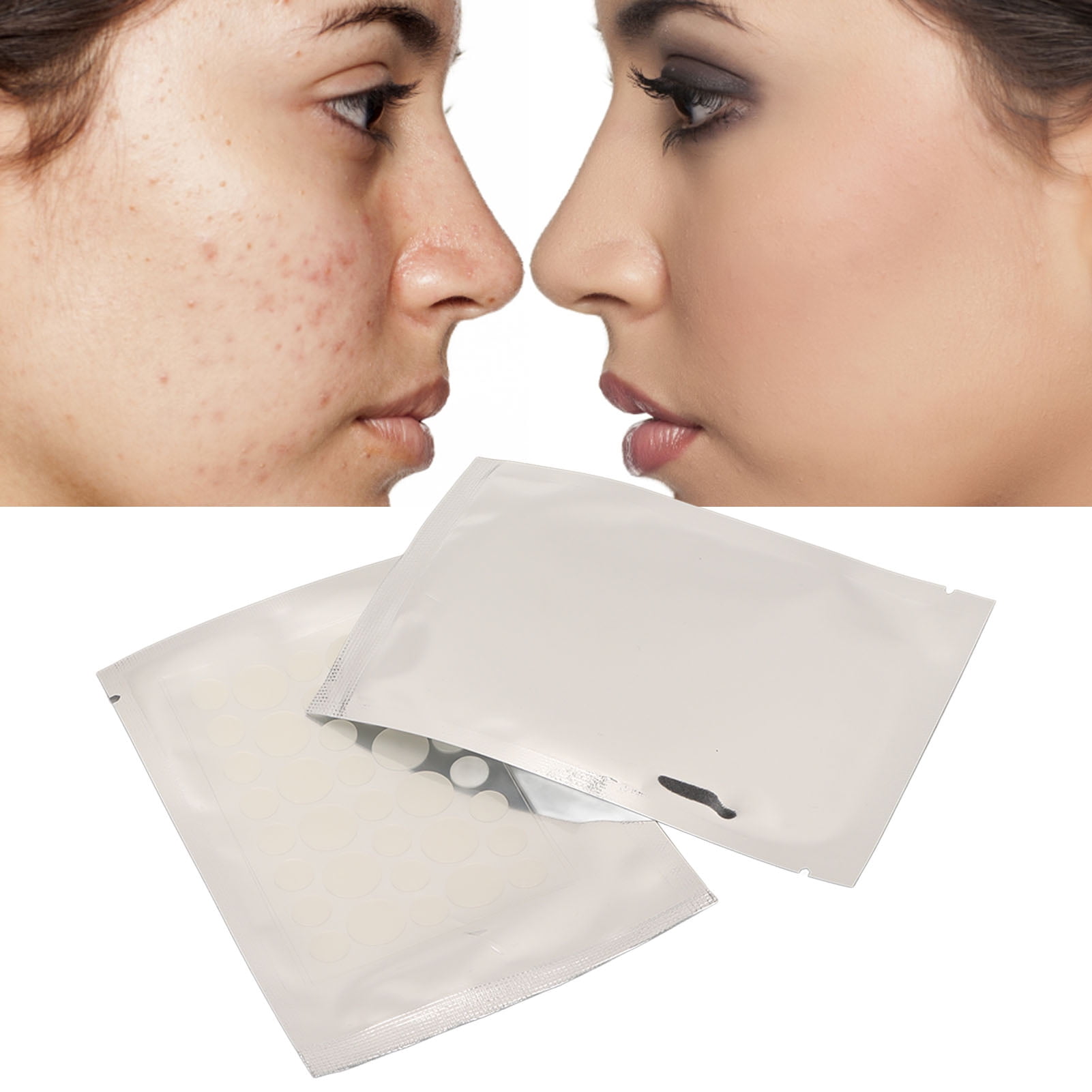 Domqga Acne Pimple Patch,72Pcs Spots Pimple Patches Cover Blemishes