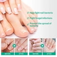 thumbnail image 5 of Tratamiento de hongos en las uñas de los pies Solución antimicótica Reparación de uñas de los pies y las manos, 5 of 5
