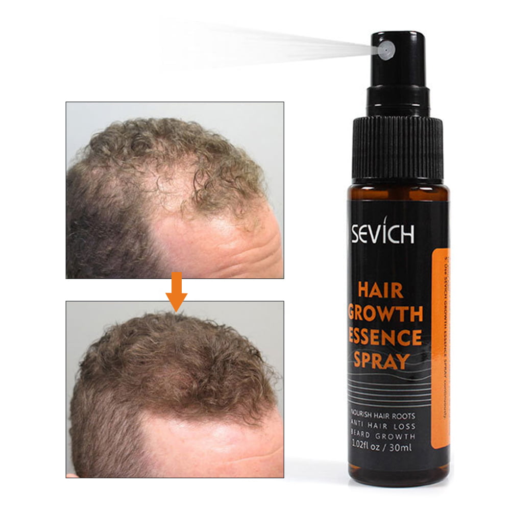Hair Growth Spray Anti Hair Loss Nourishing Hair Treatment for Men Women  30Ml 