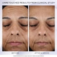 thumbnail image 4 of Crema facial Lancôme Rénergie H.P.N 300-Péptido 50 ml, 4 of 7