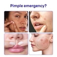 thumbnail image 2 of Tratamiento para árboles de té Spot Patch Mediheal Derma Clear, 132 parches, 2 of 8
