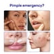 thumbnail image 2 of Tratamiento para árboles de té Spot Patch Mediheal Derma Clear, 132 parches, 2 of 8