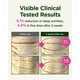 thumbnail image 3 of Crema reafirmante para el cuello CKD Retino Collagen Gua Sha [Recarga] 50 ml, 3 of 8