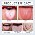 thumbnail image 4 of Tongue Cleaning Gel for Bad Breath Long Lasting-Freshness Mouth Odor-Eliminators for All Ages, 4 of 5