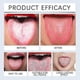 thumbnail image 4 of Tongue Cleaning Gel for Bad Breath Long Lasting-Freshness Mouth Odor-Eliminators for All Ages, 4 of 5