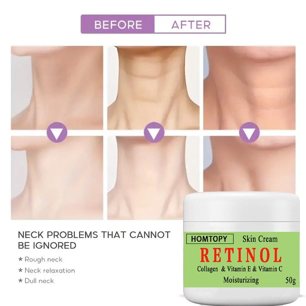 Fiudx Crema Embellecedora, Hidratante Facial Iluminador Avanzado, Fórmula Antiedad Que Reduce Las Líneas de Expresión, Tratamiento Aclarador de Manchas de Melanina, Rutina Diaria de Cuidado de La Pie