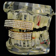 14K Gold Plated Grillz Set 4 Four Row Bling Top And Bottom Teeth Hip Hop Grills