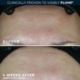 thumbnail image 6 of Roc Multi Correxion Hydrate + Plump, Daily Moisturizer with SPF 30, All Skin Types, 1.7 fl oz, 6 of 10
