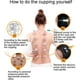 thumbnail image 3 of Juego de terapia de ventosas YONGSHENG 24 tazas con bomba para masaje y celulitis, 3 of 4