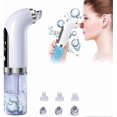 thumbnail image 2 of Blackhead extractor - Pore cleaner - USB - Blackhead charging,blue, 2 of 5