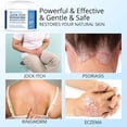 thumbnail image 3 of Hermon Jock Itch Cream: Ringworm Treatment for Humans, Athlete's Foot Cream -Fast and Effective Symptom Relief of Itching, Burning and Redness -100ml, 3 of 10