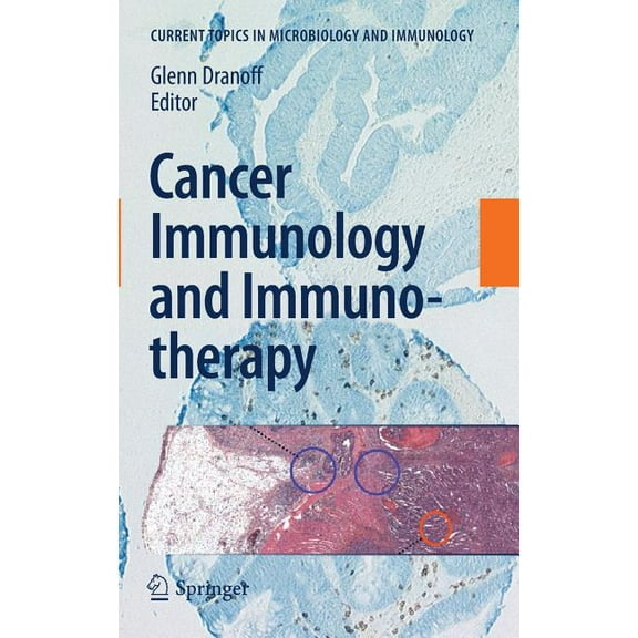 Current Topics in Microbiology and Immmu Cancer Immunology and Immunotherapy, Book 344, (Hardcover)