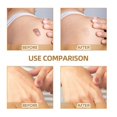thumbnail image 4 of WIFKLSIIPG Skin Concealer Skin Scar Mark Covering Patch Skin Tone Patch, 4 of 7