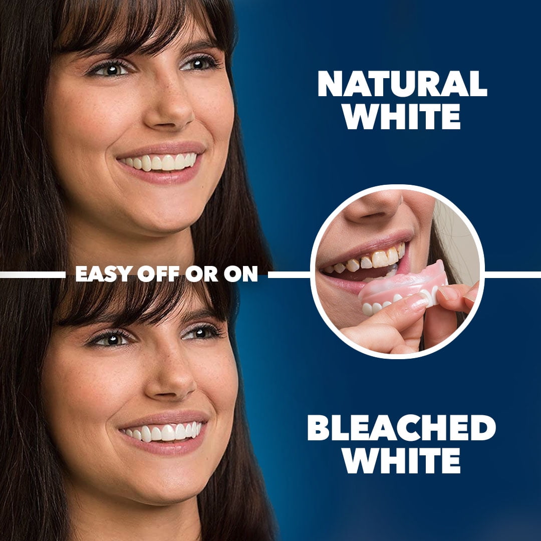 Imako Premium Cosmetic Teeth - 1 Pack - Small, Bleached White - Upper Veneers - Custom Fit at Home, DIY Smile Makeover, Made in USA
