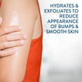 thumbnail image 4 of CETAPHIL Daily Smoothing Moisturizer for Rough and Bumpy Skin | 10 fl oz | For Rough, Sensitive Skin | Urea Cream Hydrates and Exfoliates to Smooth Skin | Fragrance Free | Dermatologist Recommended, 4 of 10