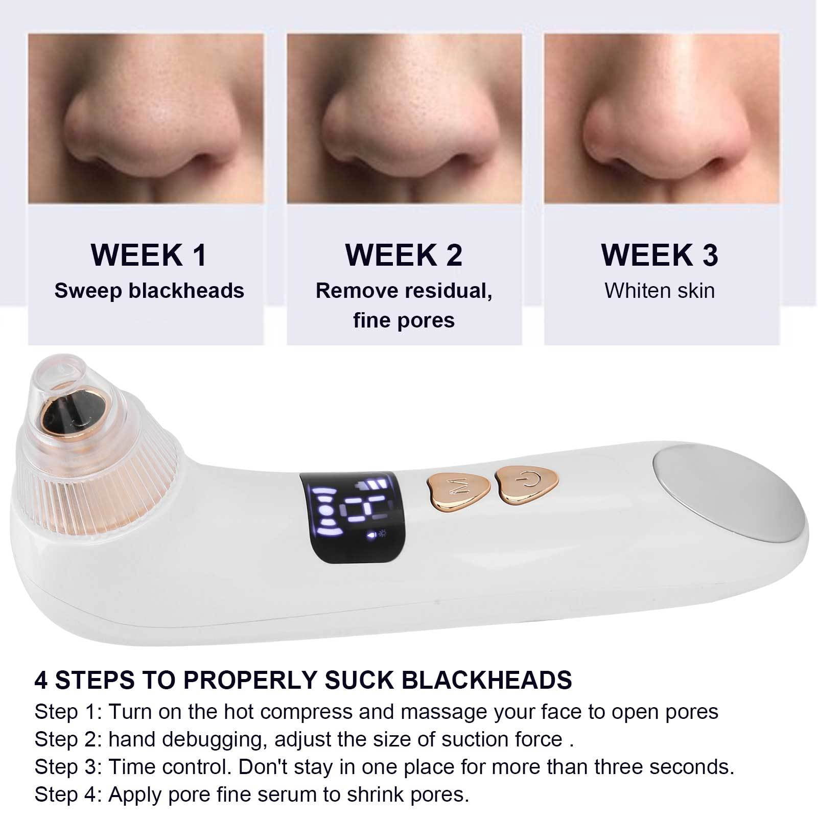 Yajisi Visual Blackhead Remover Vacuum Pore Cleaner with Hot Compress 5 Suction Levels 6 Replaceable Probes for Facial Deep Cleaning 7.87 x 5.51 x 1.97 in