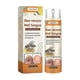 thumbnail image 1 of natural nail care solution for ingrown toenails, 1 of 5