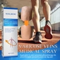 thumbnail image 4 of Tratamiento de venas Spray de tratamiento de venas varicosas, Tratamiento de venas Spray de tratamiento de venas varicosas, Tratamiento de venas varicosas de piernas kaili Sencillez, 4 of 5