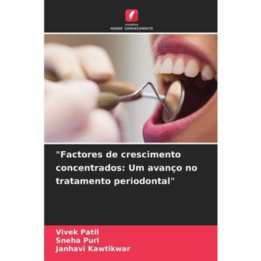 "Factores de crescimento concentrados: Um avanço no tratamento periodontal", (Paperback)