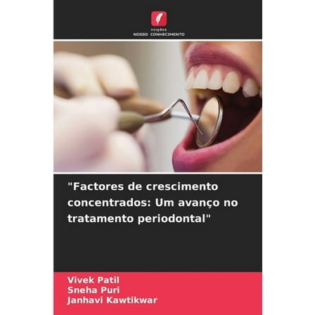 "Factores de crescimento concentrados: Um avanço no tratamento periodontal", (Paperback)