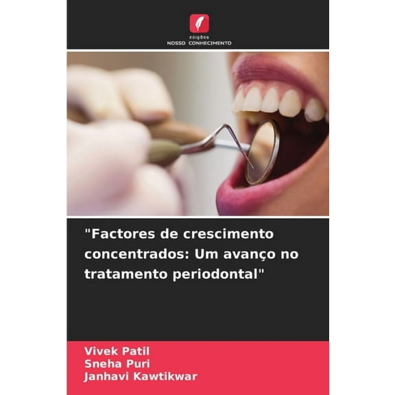 "Factores de crescimento concentrados: Um avanço no tratamento periodontal", (Paperback)