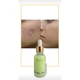 thumbnail image 3 of Magic Aloe Serum Magic Aloe Serum MAGIC ALOE SERUM, 3 of 3