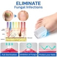 thumbnail image 5 of 2024 Nuevo, dispositivo láser para hongos en las uñas, terapia con luz, tratamiento de onicomicosis para los dedos de los pies, 910 nm - SNNGV, 5 of 5