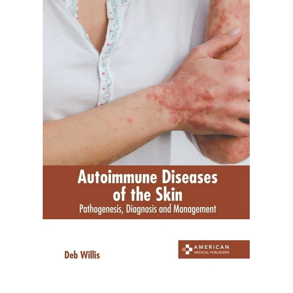 Autoimmune Diseases of the Skin: Pathogenesis, Diagnosis and Management, (Hardcover)