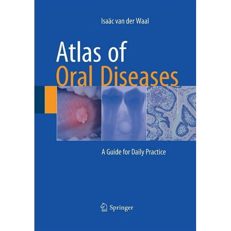 UPC: 9783662517260 | Atlas of Oral Diseases: A Guide for Daily Practice (Paperback)