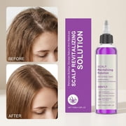 Scalp Care,Scalp Exfoliator,Scalp Revitalizing Solution – Gently Removes Buildup, Excess Sebum And Residues, Gently Exfoliates Scalp, Soothes Scalp, Deeply Cleanses Scalp(100ml/3.38fl.oz)