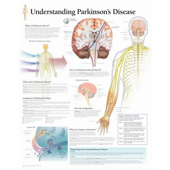 Understanding Parkinson's chart : Laminated Wall Chart (Wallchart)
