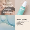 thumbnail image 4 of Loción exfoliante Paula's Choice CALM 1% BHA para piel sensible 100 ml, 4 of 6