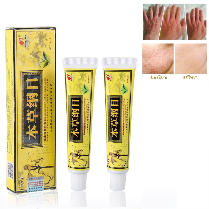 2 Pack Antifungal and Antibacterial Anti-itch Cream Relief Lotion