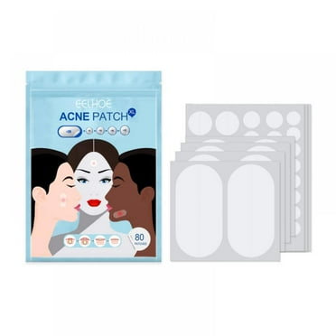 Acne Pimple Patches, 5 Sizes 80 Patches for Large Zit Breakouts, Acne Patches for Face, Chin or Body, Acne Spot Treatment with Tea Tree & Calendula Oil, Hydrocolloid Bandages for Acne Skin