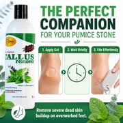 SPA REDI - Callus Remover for Feet Gel, Mint and Eucalyptus, 12 Oz - Professional Pedicure Foot Care - Removes Toughest Calluses in Seconds and Smooths Dry Cracked Heels