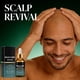 thumbnail image 5 of Pisexur Belleza Maquillaje Suero para el cuidado de la calvicie: hidratante con ácido hialurónico para el cuero cabelludo masculino, alivia la sequedad y protege (30 ml)para mujeres y hombres, 5 of 9