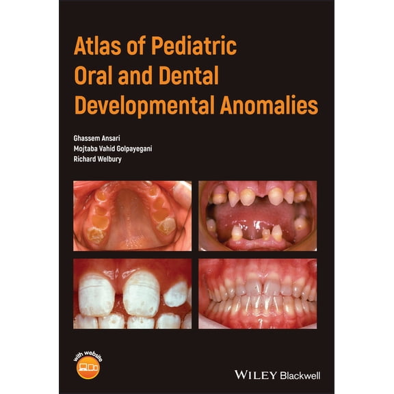 Atlas of Pediatric Oral and Dental Developmental Anomalies, (Paperback)