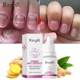 thumbnail image 3 of Ongle Ongle Orteil 10ml, 3 of 7
