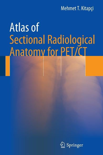 健康・医学 Grant's ATLAS OF ANATOMY Grant's Atlas of Anatomy (Lippincott Connect): 9781975210328