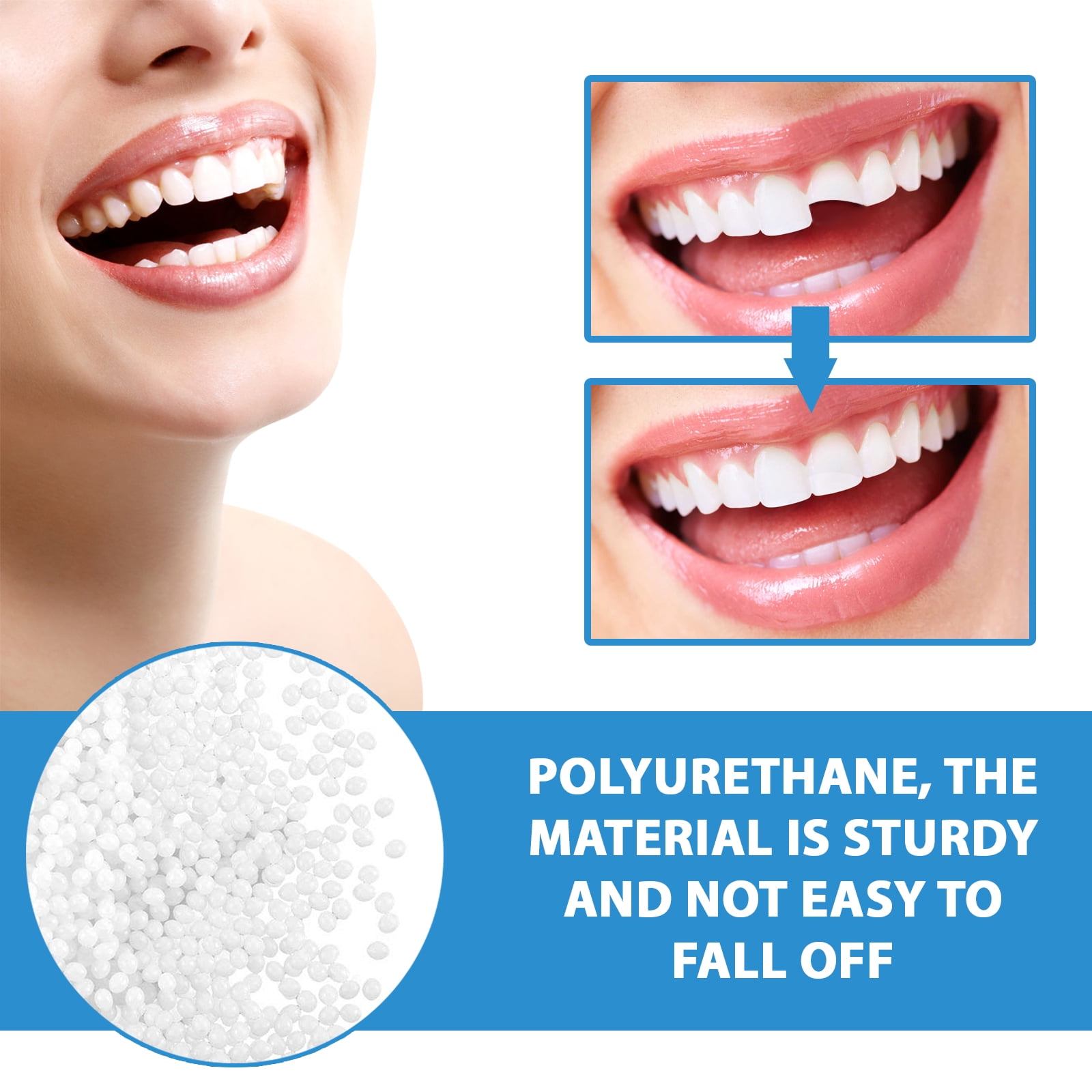 Alvantor Tooth Replacement Kit with Repair Beads for Missing and Broken Teeth, 1.05 oz, 8PC