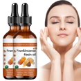 thumbnail image 4 of Organic Frankincense Oil, Soothing Hydration for All Skin Types（60ml）1/2/3/4/5/6PCS, 4 of 8