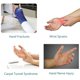 thumbnail image 4 of Férula de mano órtesis funcional de dedo Octpeak Soporte de mano ajustable, 4 of 7