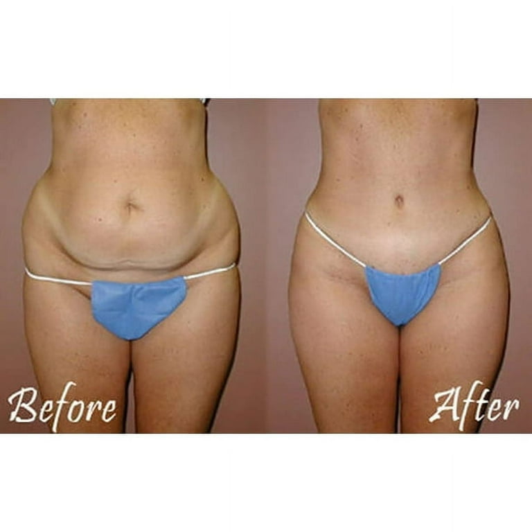 Tummy Tuck Miracle Slimming System Belt TRUSTED ORIGINAL As on