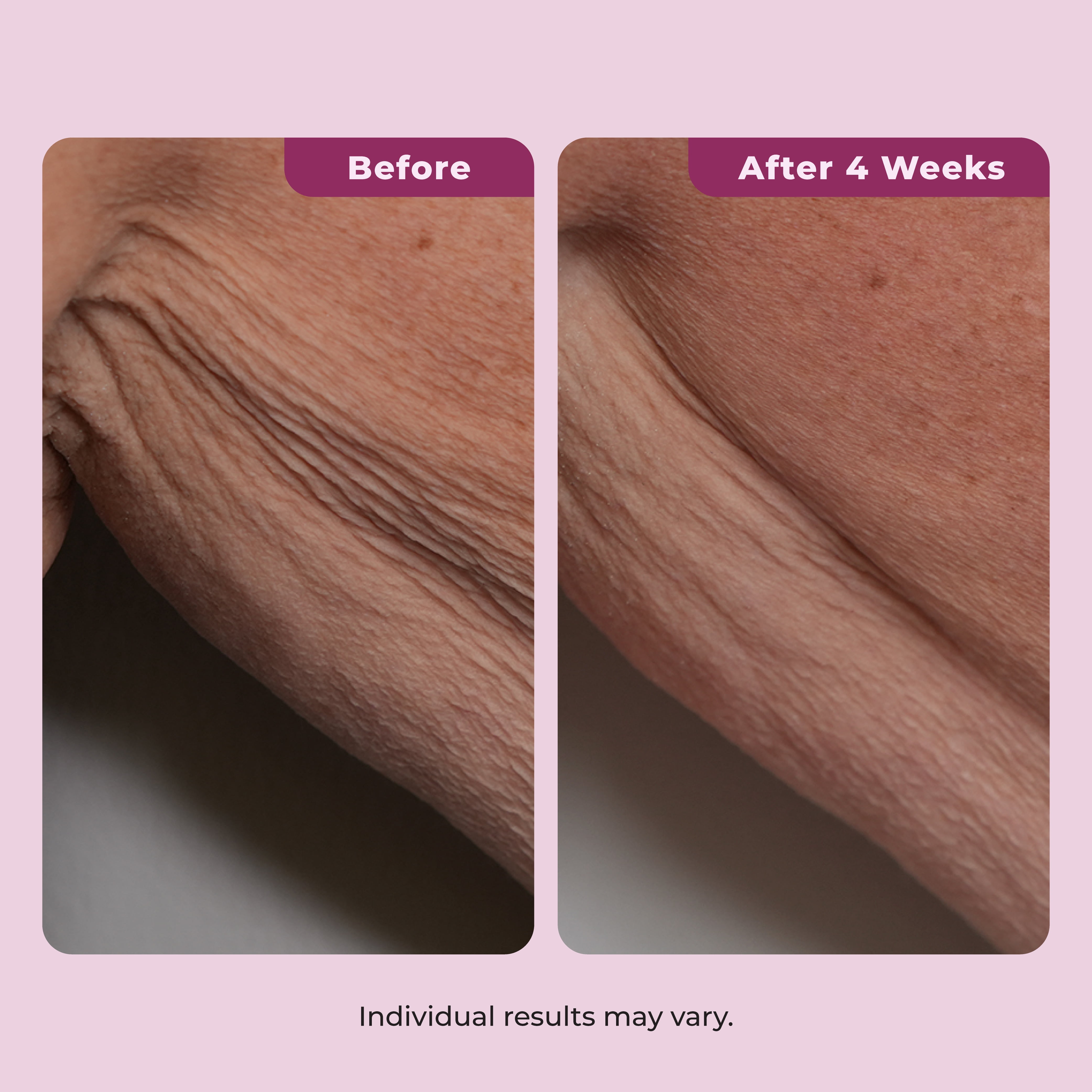 Dekliderm Neck Firming Cream for Neck, Chest & Arms – Tightening and Smoothing Cream for Crepey Skin, Wrinkles & Sagging Appearance