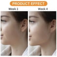 thumbnail image 5 of Jawline Exerciser, Jaw Exerciser For Men And Women, Jaw Trainer, 5 of 5