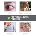 thumbnail image 4 of JFBUJC 1-4 Pcs Gouttes pour les Yeux Soulagement de l'Inconfort des Yeux Rouges Soin des Yeux Flou Prurit Sec Nettoyage, 4 of 4