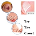 thumbnail image 4 of Qarigey Corrector de uñas de 10 piezas, herramienta de corrección de uñas de los pies, tratamiento de uñas encarnadas para el dedo del pie, Ayudas para vestirse con gancho de botón, 4 of 6