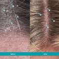 thumbnail image 2 of Dandrene Exfoliating Anti-Dandruff Conditioner - 205ml (7 Fl Oz), 2 of 7