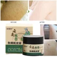 thumbnail image 5 of Crema reparadora de piel de pollo, queratosis, folículo Pilaris, manchas oscuras del cuerpo, elimina los poros gruesos, hidratante, loción de esencia suave, 5 of 5