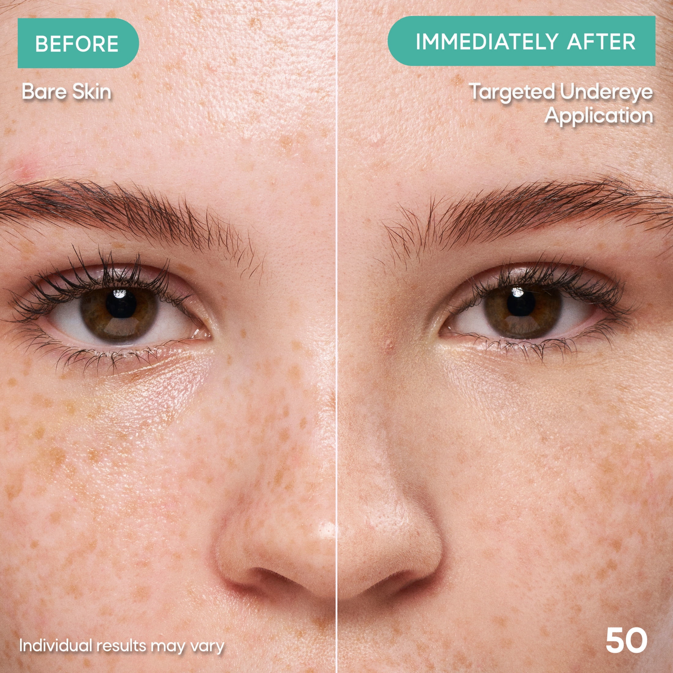 Almay Clear Complexion Concealer, Cruelty-Free Makeup for Acne-Prone Skin, Non-Comedogenic, Vegan, Hypoallergenic, 200, 0.3 fl oz